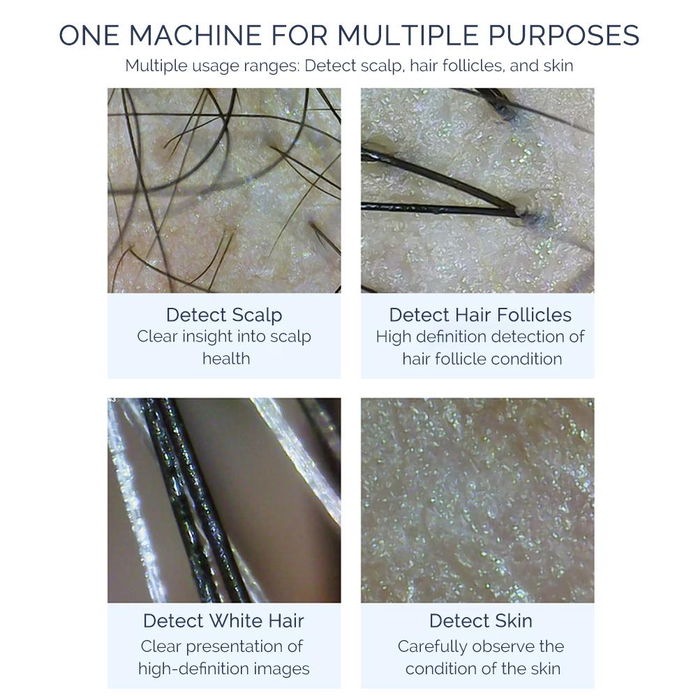 50X/200X Magnifying Mini Hair Follicle Scalp Detector Portable Skin And Hair Eetector Skin Tester Skin Analyzer Pore Magnifier