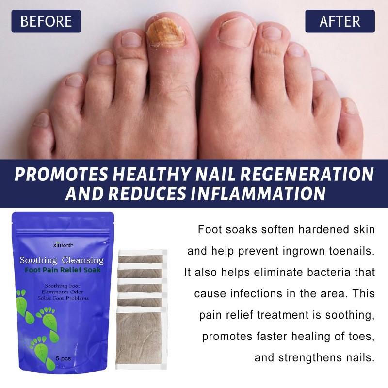 Ximonth Foot Soak Pack For Relieving Swollen Feet And Pain With Moisturizing Care