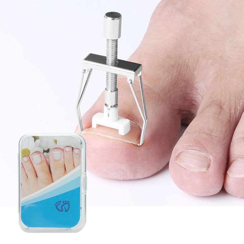 Ingrown Toenail Fixer Adjustable Toe Nail Paronychia Corrector Pedicure Care Tool Set