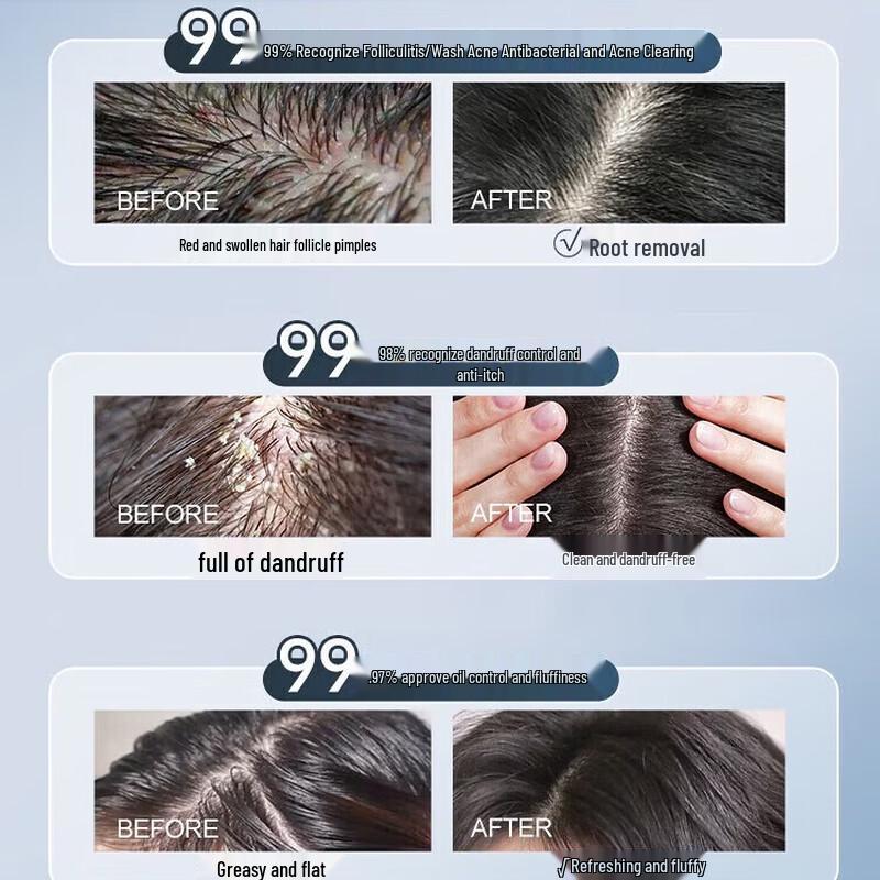 Korean Herbal Follicle Purifying Shampoo