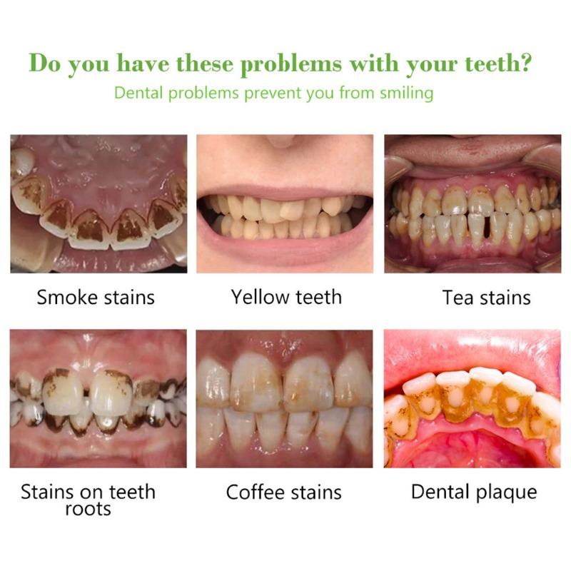Teeth Brightening Tooth Cleaning Liquid to Remove Tooth Stains, Smoke Stains, Tartar, Oral Cleaning