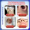 Rhinitis Allergic Rhinitis Spray Adult Children Sinusitis Stupid Eyes Itching Sneezing Runny Nose