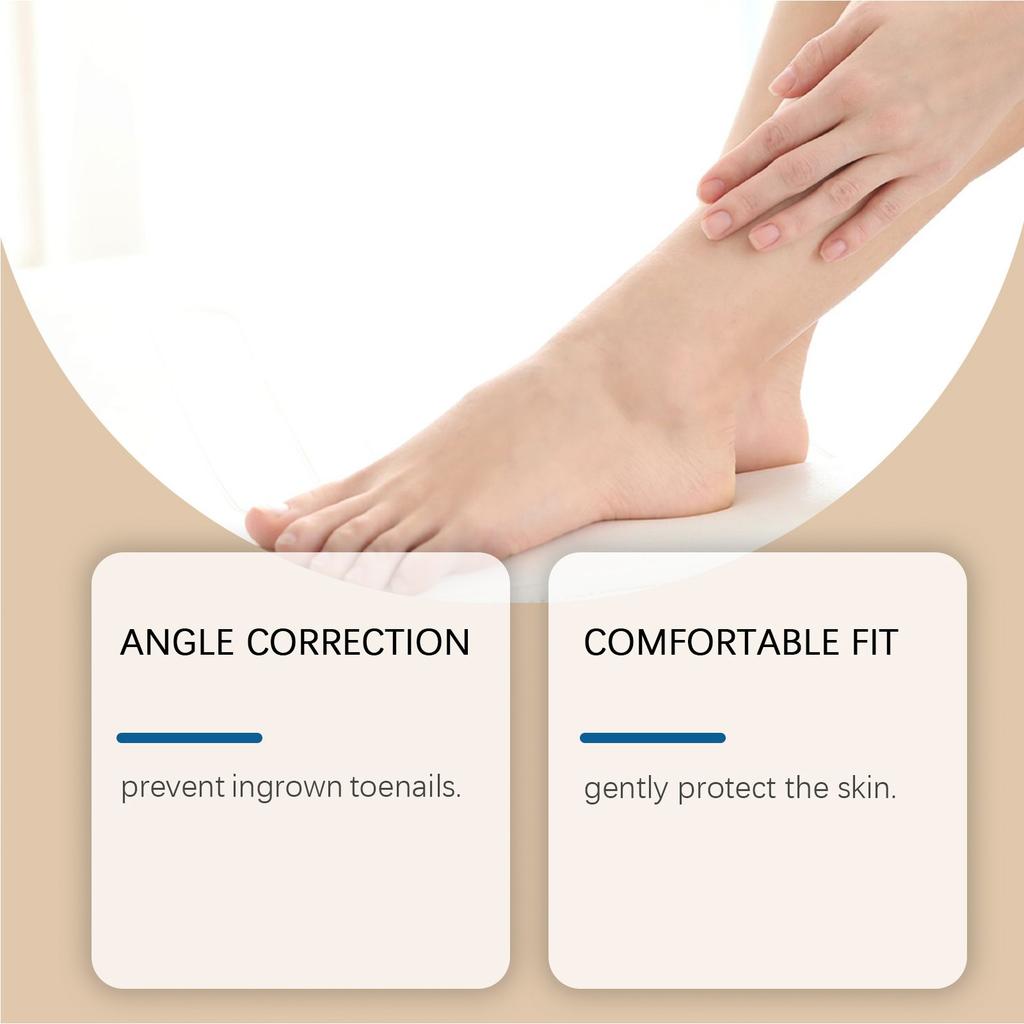 Breathable Curved Toenail Corrector Set; Toenail Correction Stickers; Nail Care