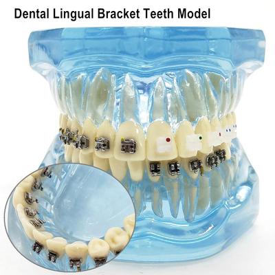 1 Piece Dental Orthodontic Teeth Model with Lingual Bracket Ceramic and Metal Brackets for Patient Communication Dental Study Tooth Mold