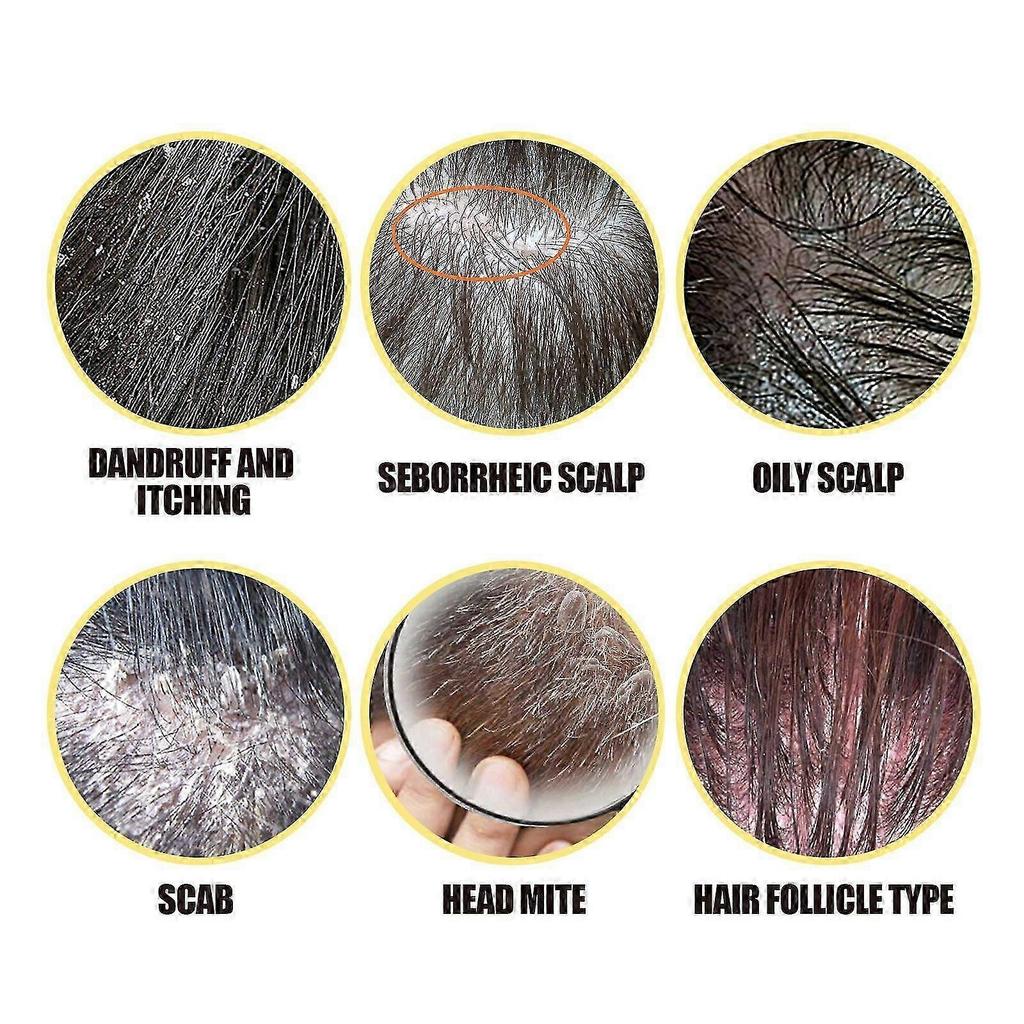 Shampoo allo Zolfo per la Cura del Cuoio Capelluto - Allevia Prurito, Forfora, Dermatite Seborroica