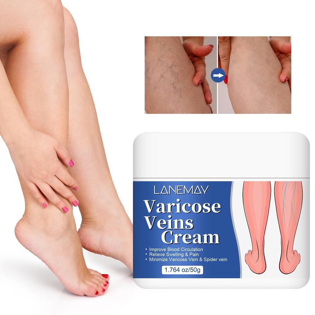 Varicose Veins Cream-Improve Blood Circulation-Relief Swelling And Pain-Minimize Varicose Vein & Spider Vein, 50g