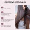 Huile de croissance des cheveux Stimule la croissance des cheveux Huile infusée d'huile, d'huile de ricin et d'huile de graine noire pour toutes les qualités de cheveux, 100 ml