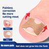 Ingrown Toenail Toe Correction Stickers Paronychia Treatment Recover Corrector Patches Feet Care Paronychia Treatment Recover
