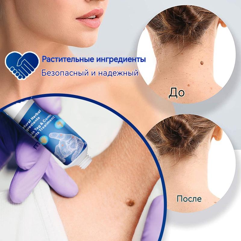 ZB Mole Removal Ointment Skin Care Mild Ingredients Collagen Daily Skin Care