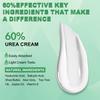 60% Harnstoffcreme mit Aloe Vera, Für trockene, rissige Haut und Hände, Entfernt Hornhaut und macht die Haut weich, Spendet tiefenwirksam Feuchtigkeit 350G