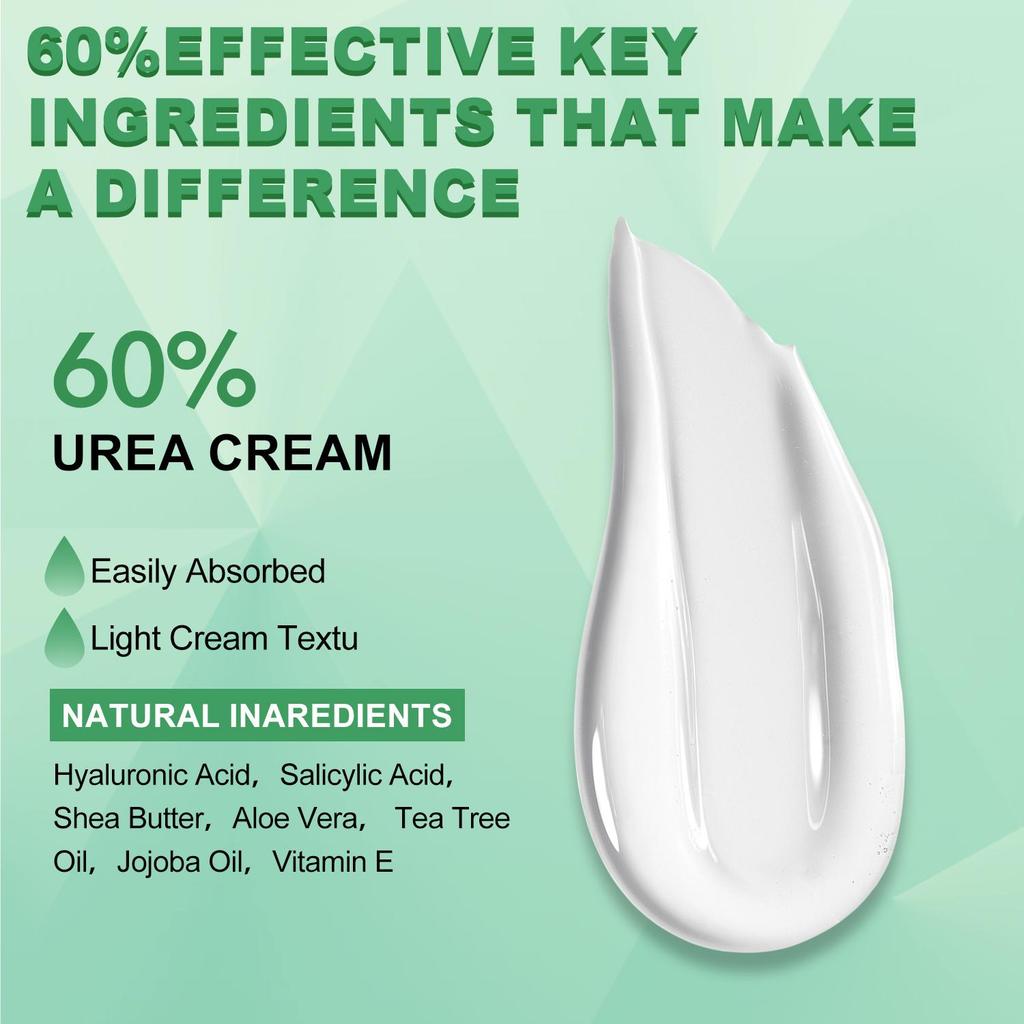 60% Harnstoffcreme mit Aloe Vera, Für trockene, rissige Haut und Hände, Entfernt Hornhaut und macht die Haut weich, Spendet tiefenwirksam Feuchtigkeit 350G