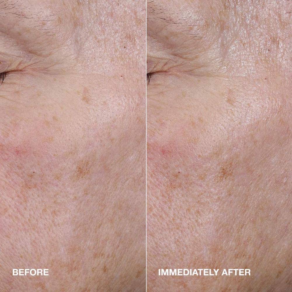 Clinique Moisture Surge  Active Glow Serum With Hyaluronic Acid 1.7 Oz   50 Ml