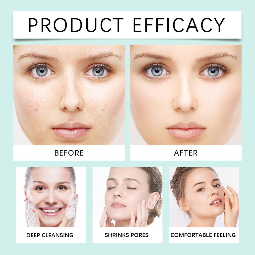 Facial Soap Deep Cleansing, Shrinks Pores, Suitable For Sensitive Skin, Oily Skin, Care, Oil Control Ingredients.