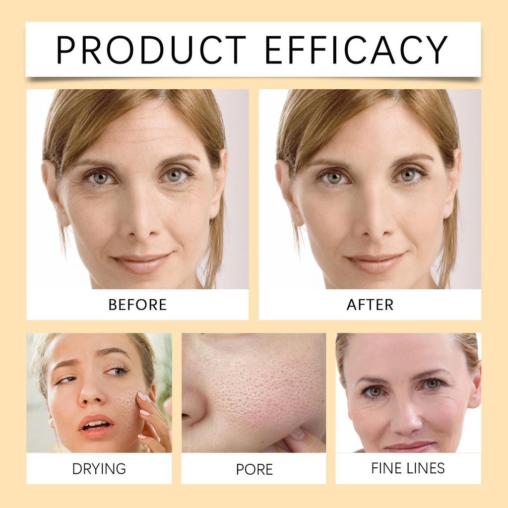 OUHOE Lemon Turmeric Brightening Soap Gently Cleanses Moisturizes and Hydrates Suitable for Whole Body Use 100g