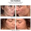 Crème blanchissante puissante anti-taches Éclaircit la peau rapidement Élimine la pigmentation mélanique Mélasma Taches brunes Soin de la peau coréen