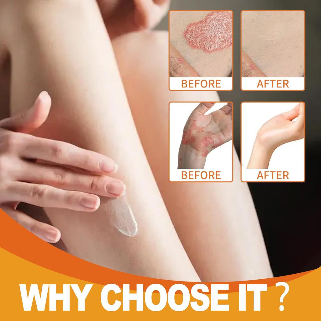 30g Bee Venom Body Cream Body Skin Nourishing Moisturizing Discomfort Relieving Care Daily Massage Applicator Cream