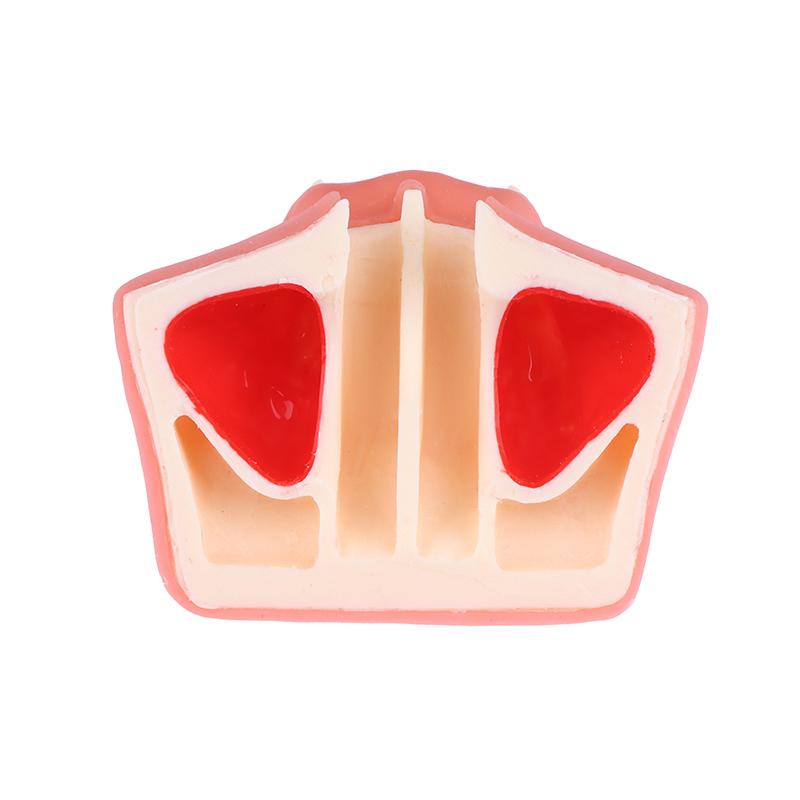 Maxillary Sinus Teeth Model Dental Implant Teaching Model For Dentist Student Practice Studying Oral Medical Model