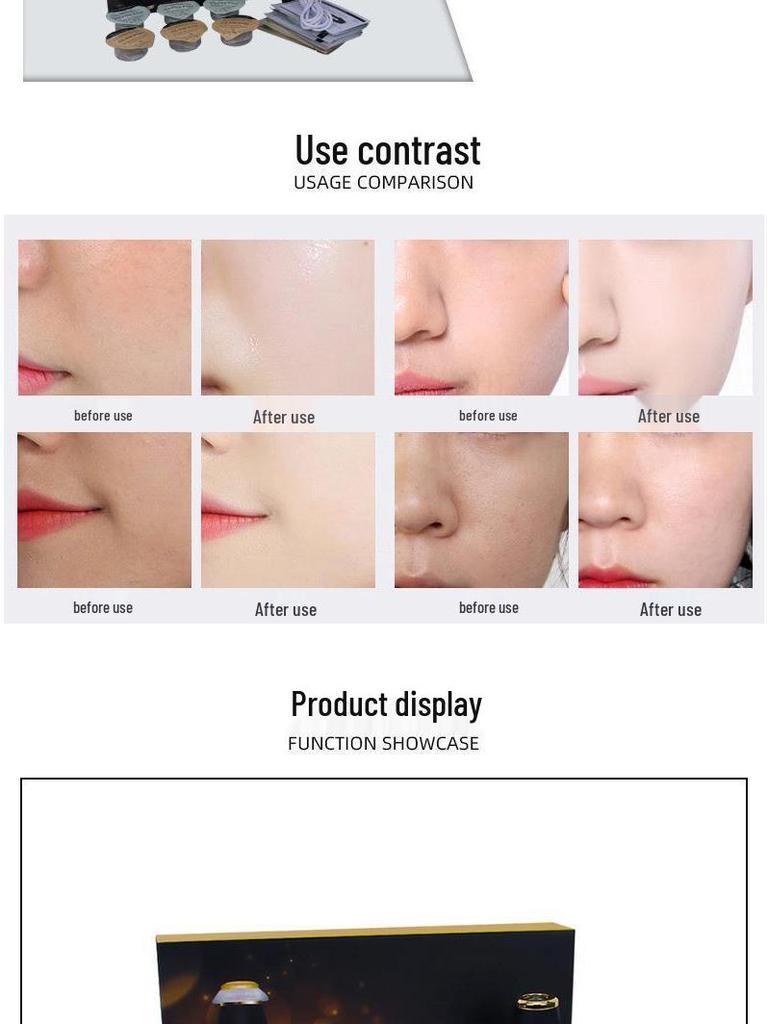 Oxygen Bubble Device: Whitening, Rejuvenating, Lifting, Firming, Deep Hydration - Exclusive to Beauty Salons.