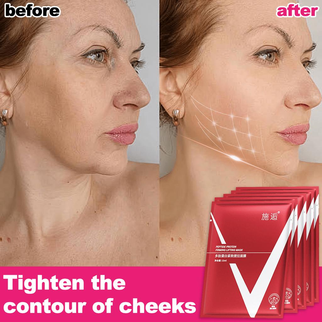 1/5/10 PCSV Lifting Facial Mask, Moisturizing And Brightening The Neck, Tightening The Double Chin