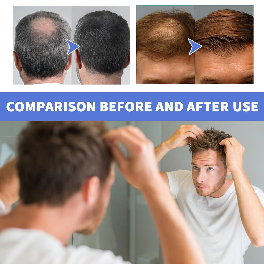 Mit Biotin angereicherter Haarwuchsschaum für superstarkes Haarwachstum, damit das Haar länger und dicker wird, 60 ml