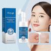 Hyaluronic Acid Cleansing Mousse Gentle Cleansing Moisturizing Exfoliating