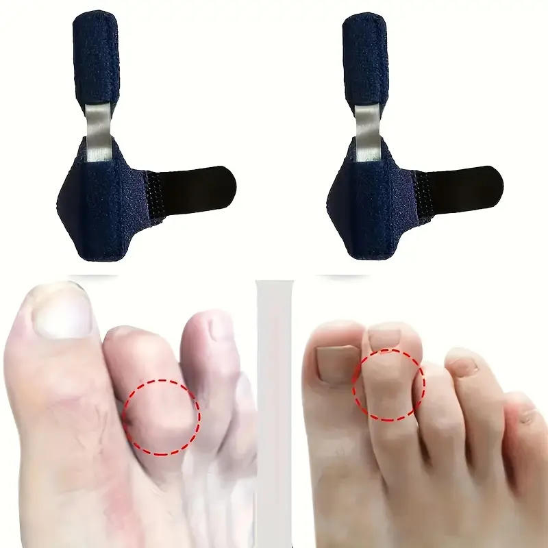 Finger Splint Brace Toe Splint Straightener for Hammer Corrector Crooked  Claw Toe Stabilizer Support Foot Finger Straightener