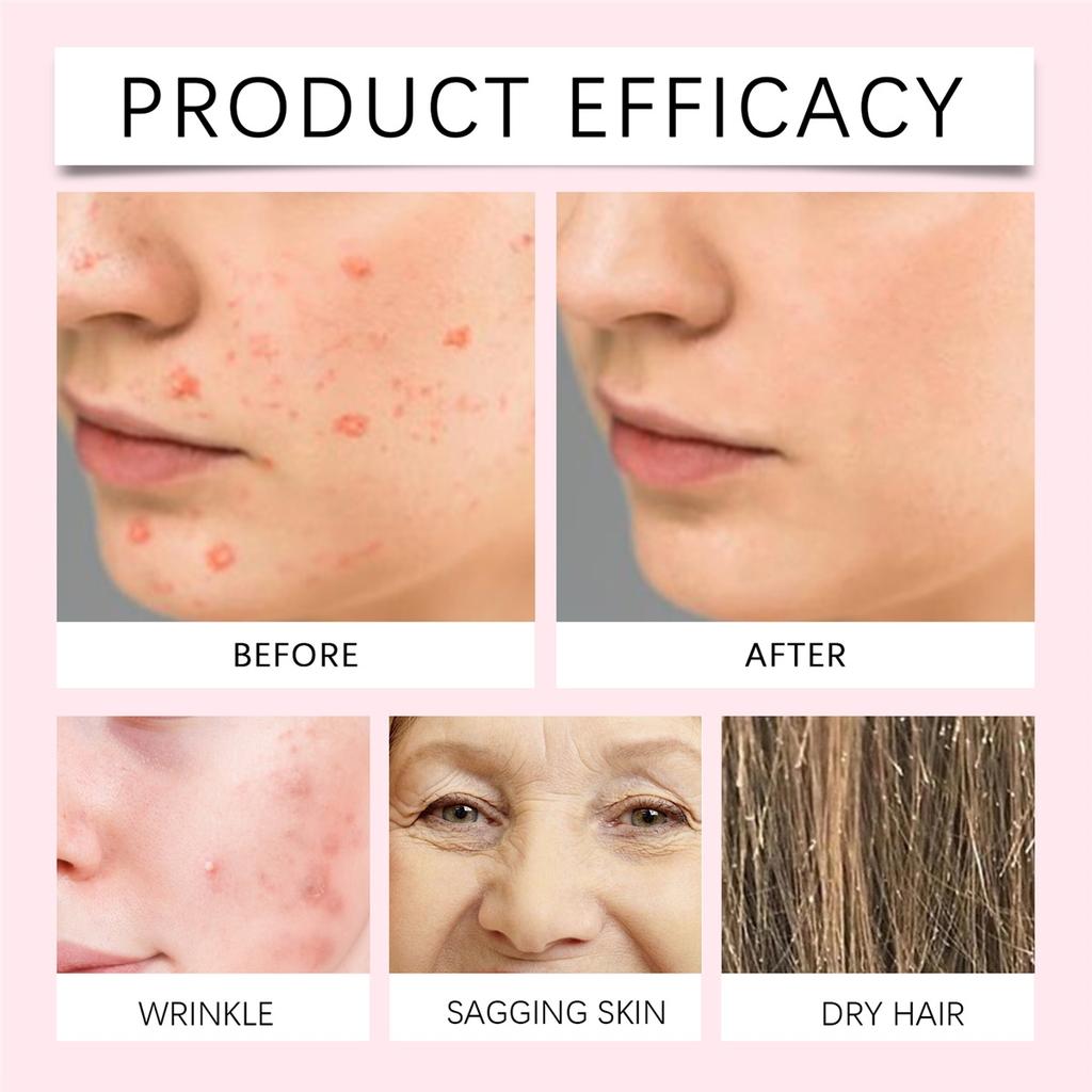 Natural Rosehip Essential Oil Fade Fine Lines Remove Wrinkles Improve Skin Elasticity Repairing Hair Moisturizing Massage Oils