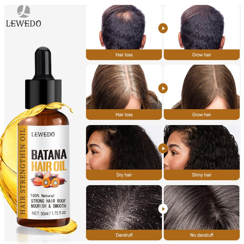 LEWEDO Naturals Batana Oil Fast Hair Growth for Men Women Pure Batana Oil Nourish Shiny Hair Healthy Hair Care Anti Hair Loss