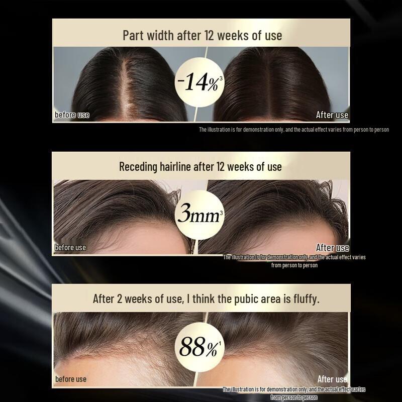 Schwarzkopf Anti-Hair Loss Essence