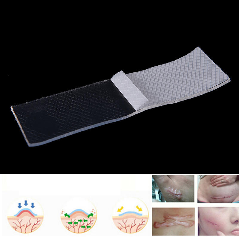 Scar Therapy Remove Trauma Burn Silicon Patch Reusable Acne Gel Skin Repair New