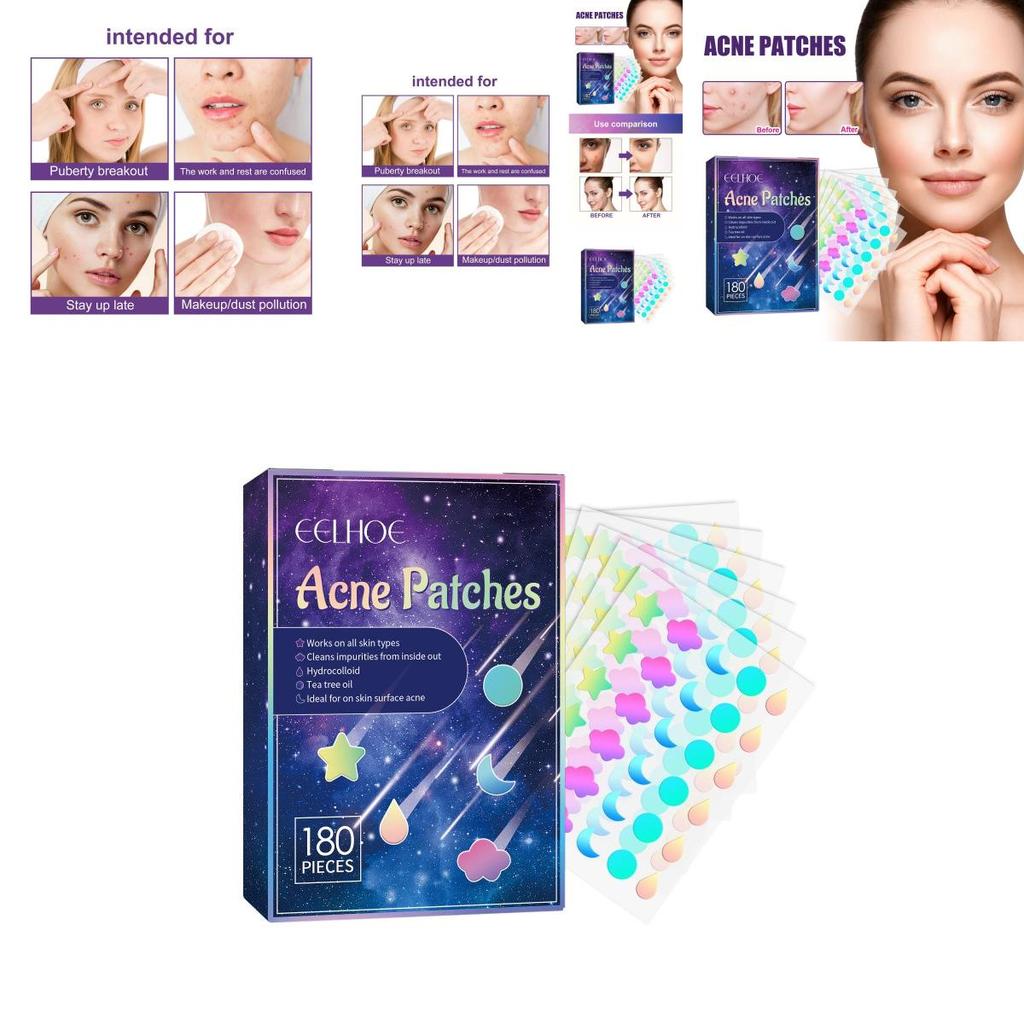 Eelhoe Pimple Patches For Effective Skin Repair And Acne Spot Treatment With 180 Pieces For Clear Complexion