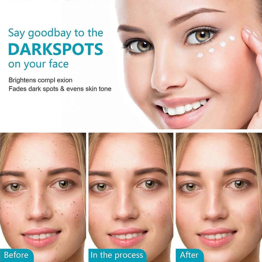 Press Whitening Spots Remover Cream, Vitamin C Freckle Solution, Brightens Skin Tone