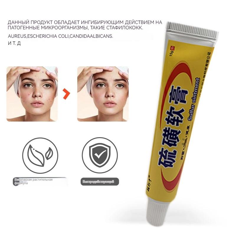 sulfuric Moss Care Relieves Skin Itching, Redness, And Swelling. Cowhide Moss Moisturizing Skin Care