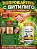 Anti Vitiligo Cream Treatment 50 G