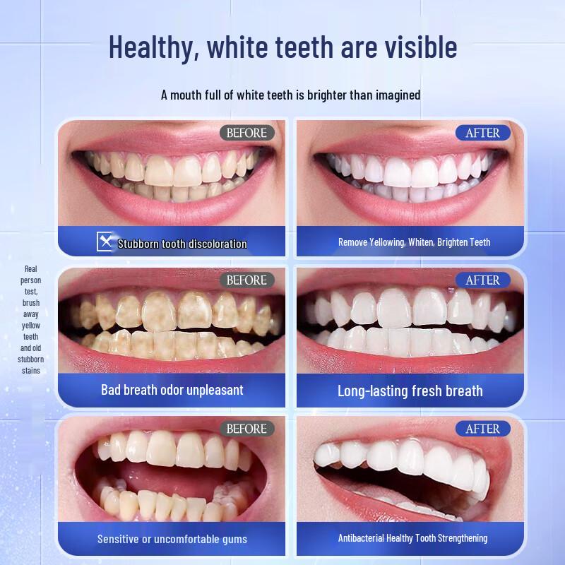ZCL Multi-Effect Whitening Toothpaste
