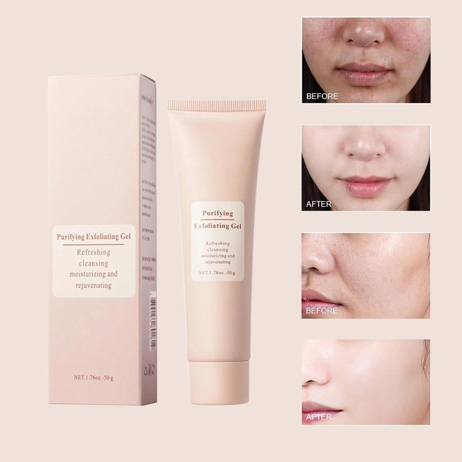 Exfoliační gelový krém: Odstraňuje odumřelou kůži, Čistí póry, Hydratuje & Zvlhčuje