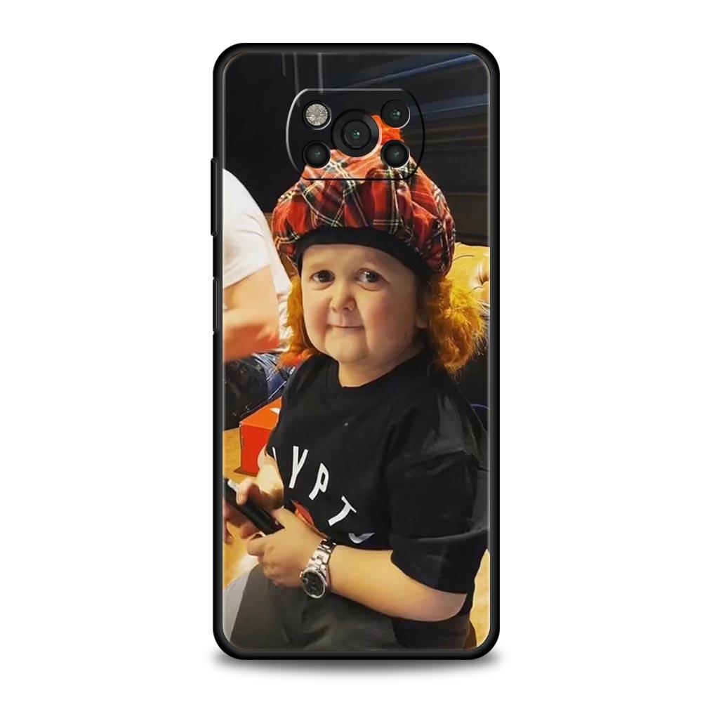 Funny Hasbulla Phone Case For Xiaomi Mi Poco X3 NFC M3 F4 F3 M4 X4 Pro 5G Note 10 12 Lite 11 11T 10T 11X 13 12T Pro 9T Cover