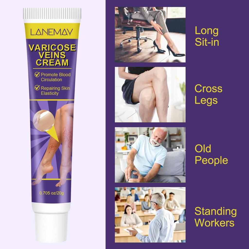 Varicose Veins Cream-Relief Phlebitis Angiitis-Promote Blood Circulation-Repair Skin Elasticity-Suitable For All Skin Types, 20g