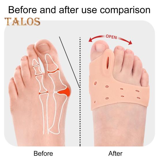 1 Pair Toe Separator for Orthopedic Bunion Foot Alignment Toe Spacer Straightener Pain Relief Shoe Inserts for Plantar Fasciitis Corns