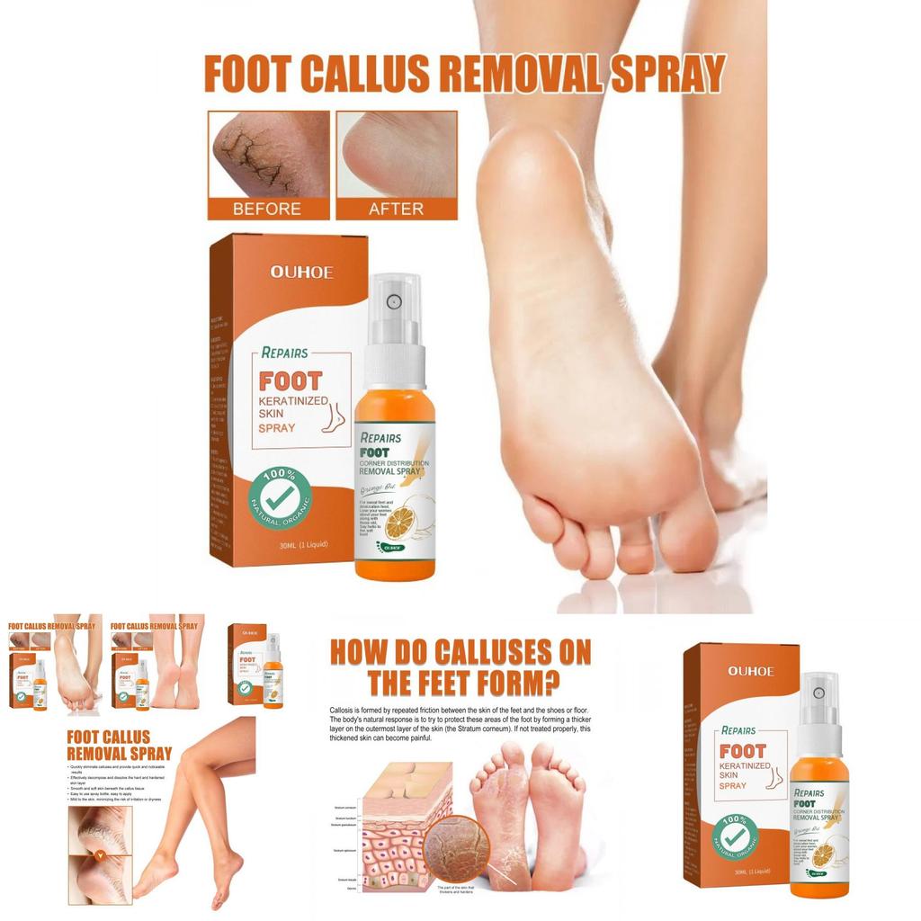 Nourishing Ouhoe Foot Spray For Softening Calluses And Cracked Heels 30ml