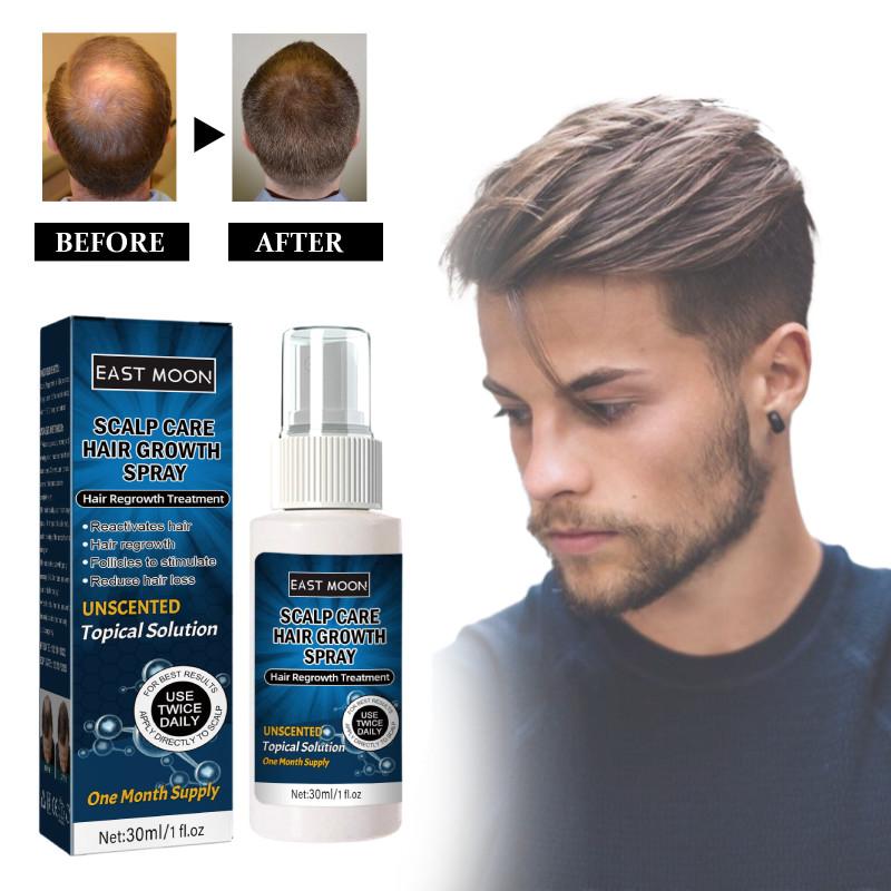 East Moon Men's Hair Growth Spray For Thicker Hairline And Prevents Hair Loss