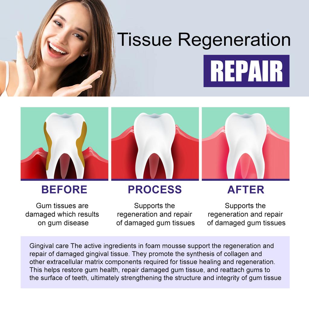 Tooth Whitening Foam Mousse Prevent Periodontitis Toothache Relief Dental Calculus Stain Removal Repair Gums Decay Oral Hygiene
