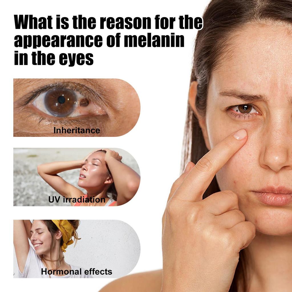 Hyaluronic Acid Eye Serum Roller Improve Eyesight Relieve Fatigue Fade Dark Circles Fine Lines Tighten Lifting Nourish Eye Care