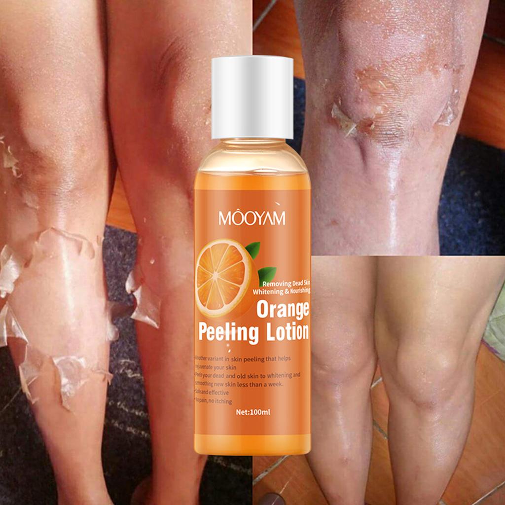 MOOYAM 100ml Orange Peeling Lotion Peeling Oil Body Lotion Gentle Exfoliating Gel Remove Dead Skin