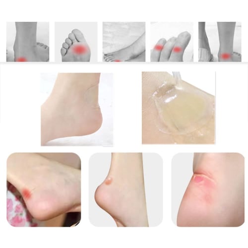 Natiform Anti-Shoe Blister Tape, 3 Styles, 15-Pack, Prevents Blisters, Safe for Long Walks