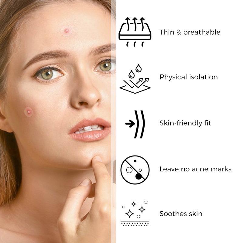 Acne Pimple Patch Repair Facial Acne Acne Cover Acne Smooth Skin Care Pimple Patch Mild Non-Irritating Skin