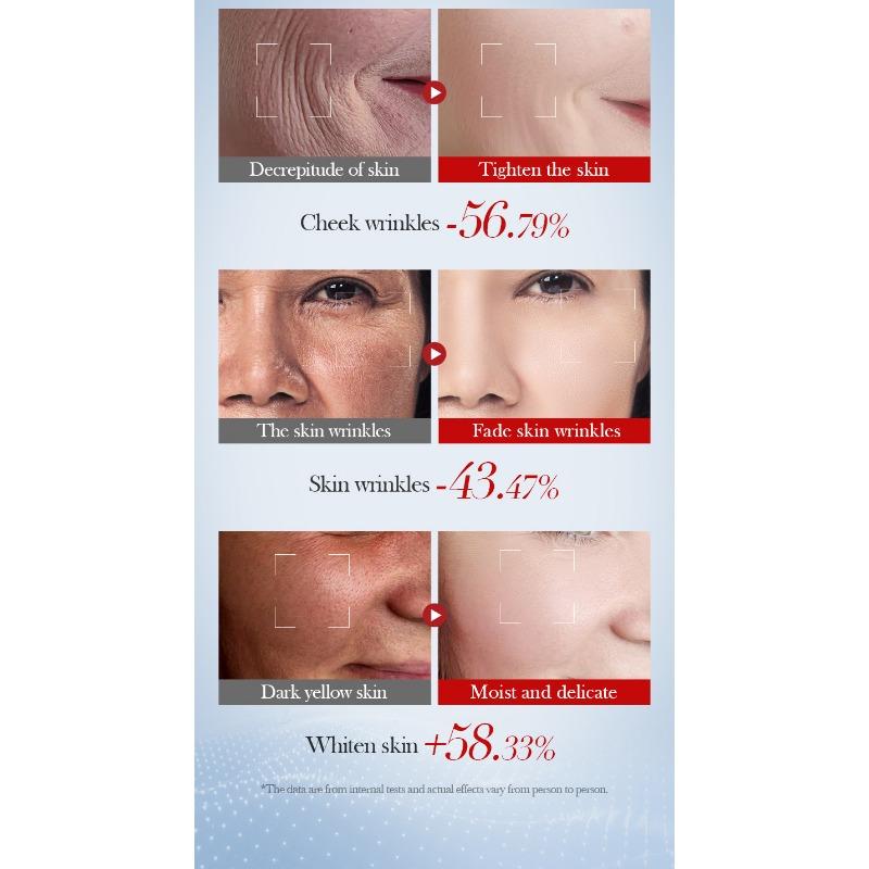 Snail Essence Brightening Double Essence Facial Tightening Whitening Moisturizing Repair Improving Dark Yellow