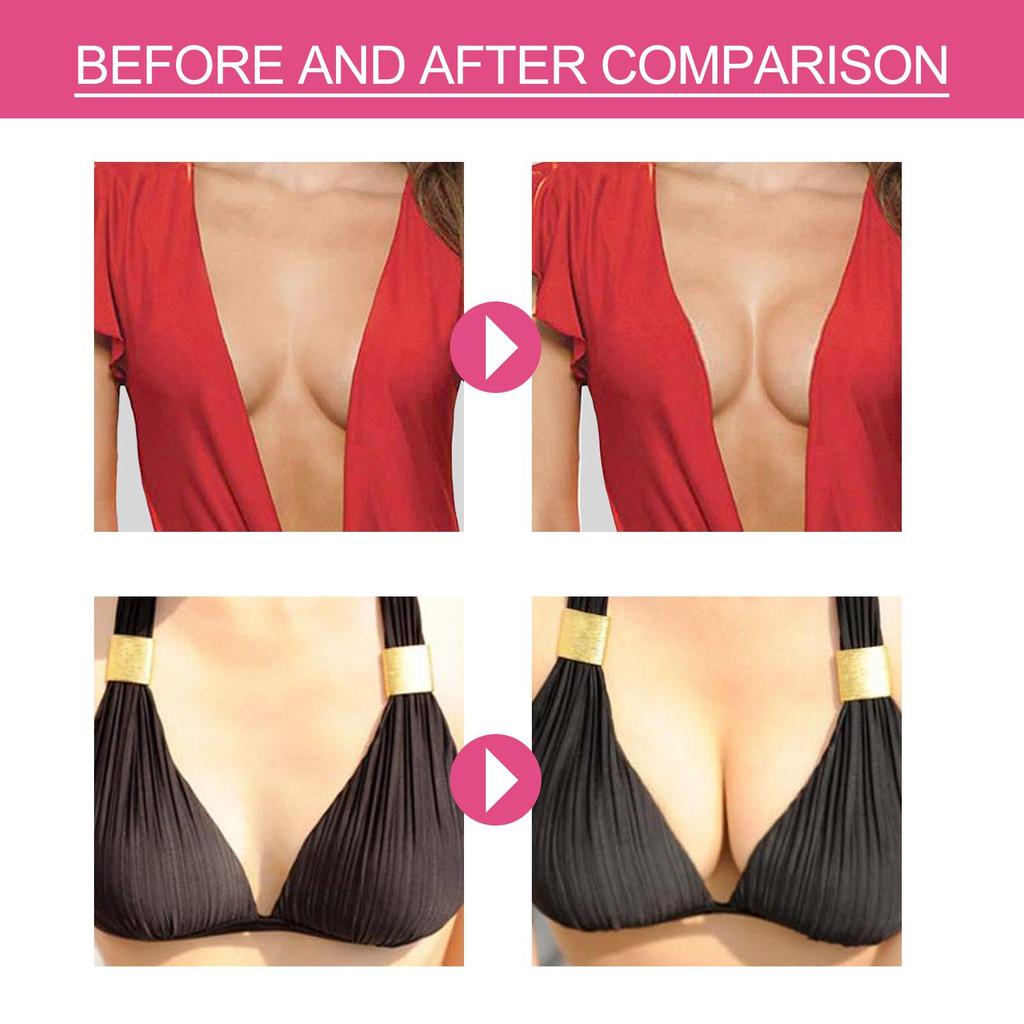 West&Month Invisible Elastic Fabric Breast Lift Tape Non-Scarring Anti-Sagging Expansion Gathering Breasts Elastic Fabric Tape