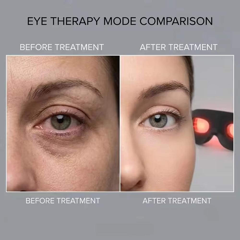 2026 New 3D Eye Beauty Massager 7 Colors LED Photon Therapy Hot Compress Fade Dark Circles Reduce Eye Relieve Eye Fatigue Massage Device Promote Sleep