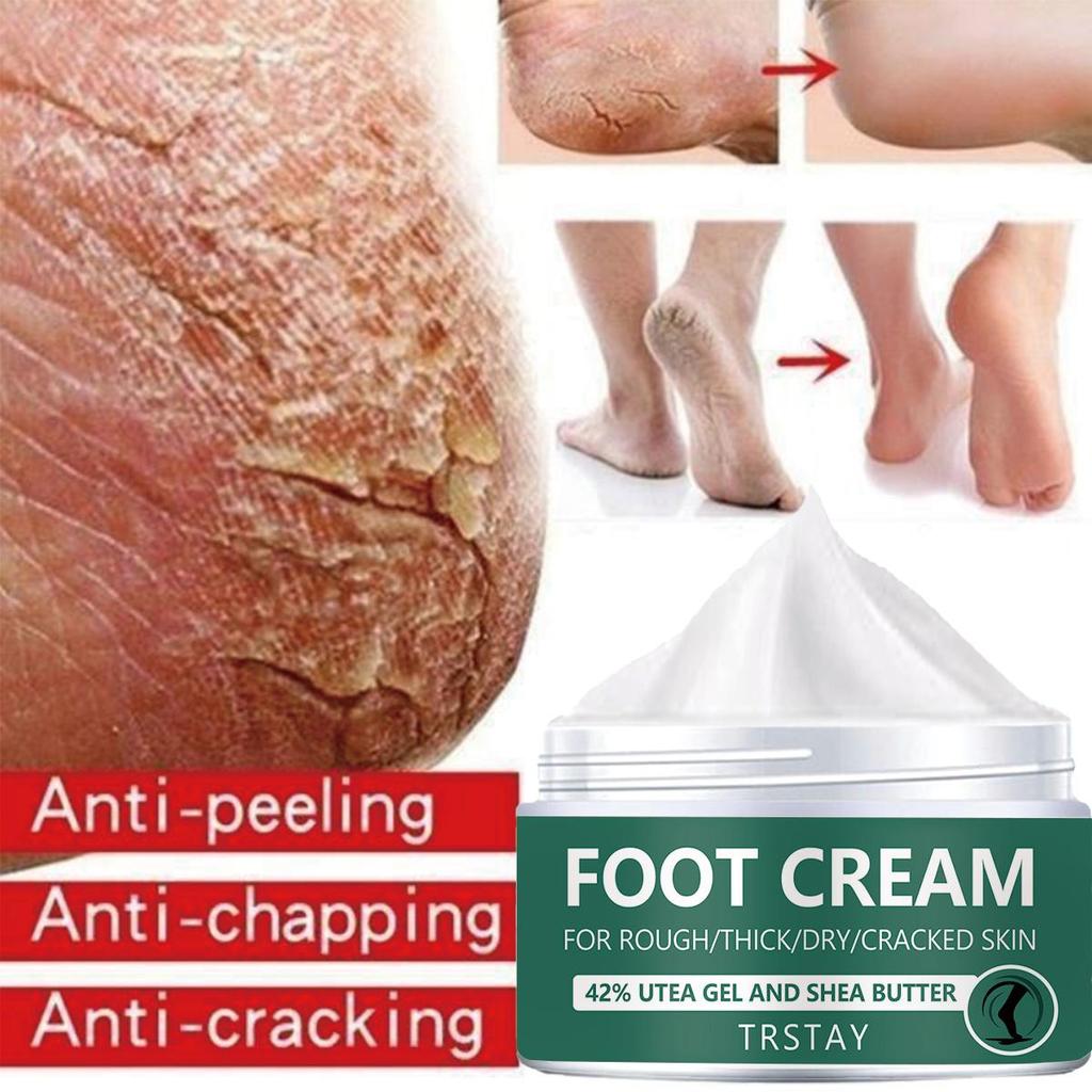 Krém na nohy, praskliny na patách k odstranění odumřelé kůže, péče o pokožku suchá maska ​​exfoliace, jemná a nedráždivá pokožka